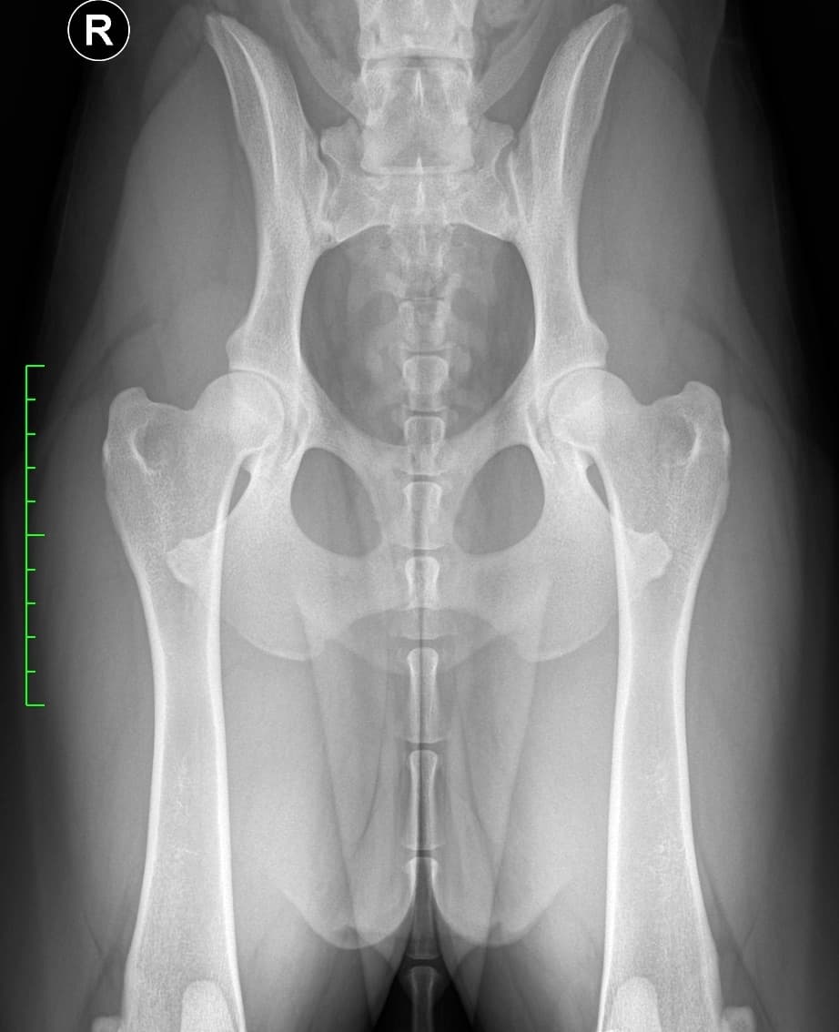 Example hip radiograph